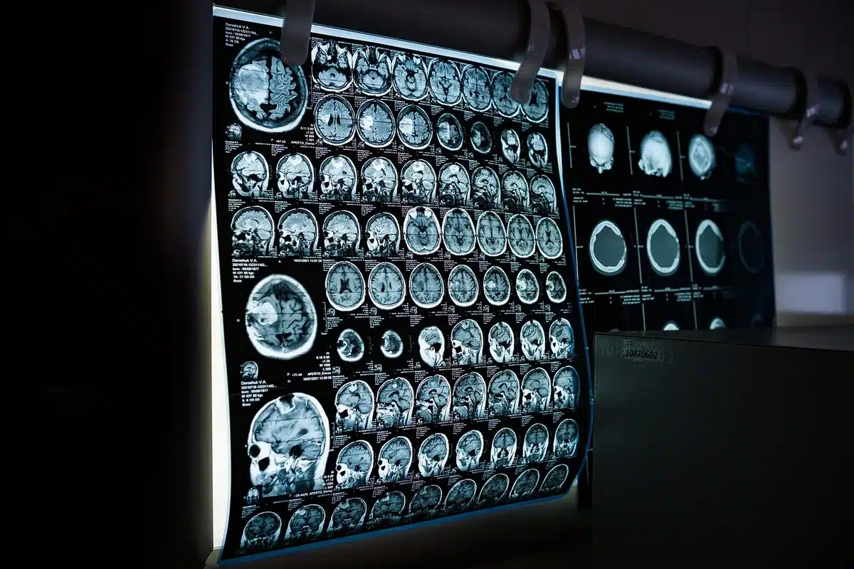 Centro diagnostico con apparecchiature per risonanza magnetica e radiologia